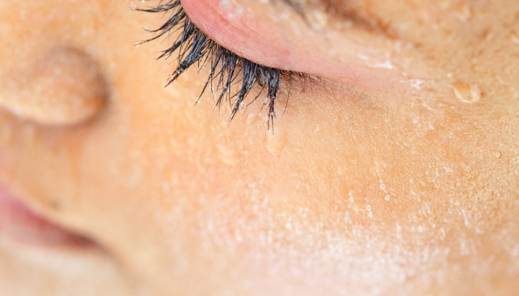 Hypochlorous skin care